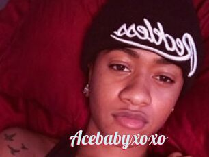 Acebabyxoxo